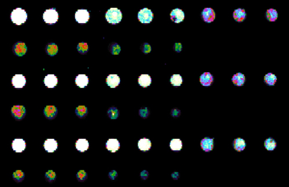 NHS_microarrays