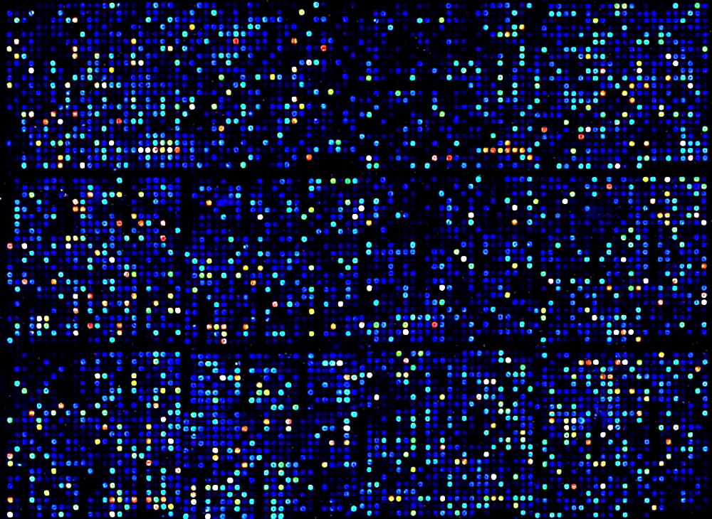 RNA-extraction