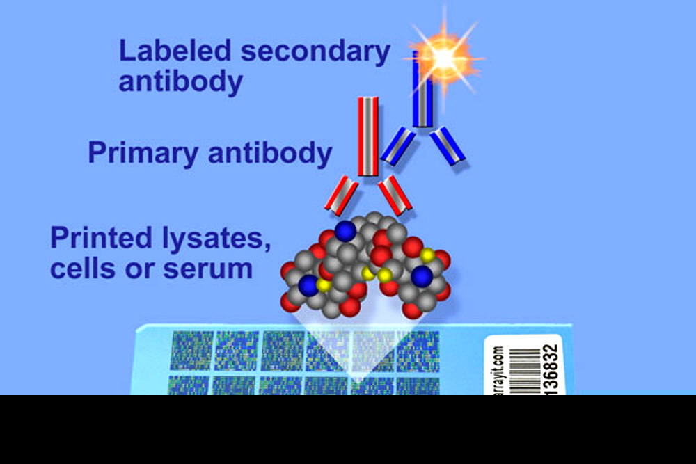 Reverse-Phase-Microarrays