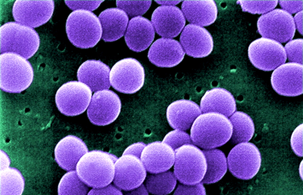 Staphylococcus aureus