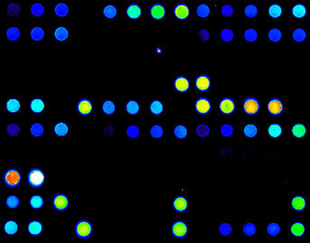 antibody_microarray-test