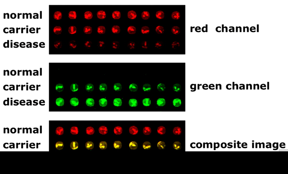 diagnostic_microarrays