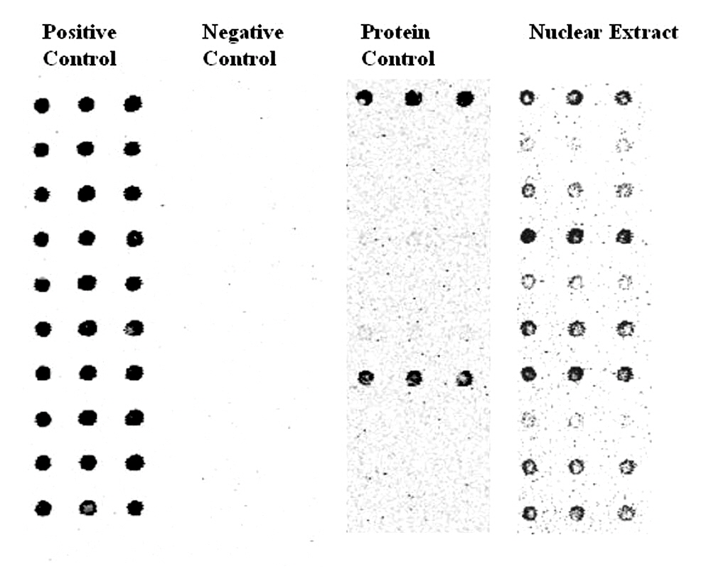 transcription-factor